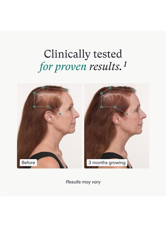 NUTRAFOL مكملات نمو الشعر للنساء من نوترافول، للأعمار 45 وما فوق، مكمل شعر مثبت سريرياً لشعر أكثر كثافة وغطاء لفروة الرأس، موصى به من قبل أطباء الجلد - إمداد لمدة شهر، عبوة إعادة تعبئة واحدة - Image 5